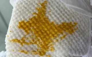 20天新生儿拉屎有泡沫是消化不良还是感染了？