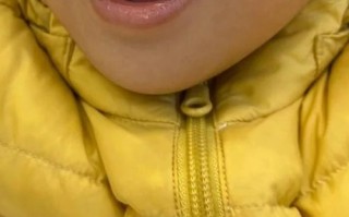 儿童舌头短一定是说话不清楚的主因吗？如何判断与科学干预？