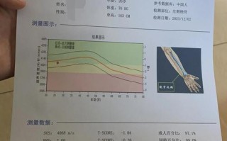 孕期骨密度检查到底重要吗？不做会有哪些风险？对母婴健康影响有多大？