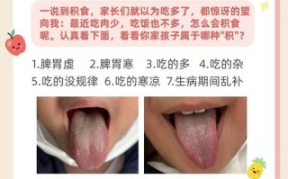 儿童舌头发白是脾胃虚还是积食？日常调理该注意饮食还是需就医？