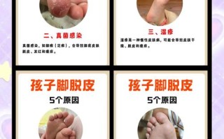 儿童手脚脱皮是缺乏维生素还是其他营养素？需如何针对性调理？