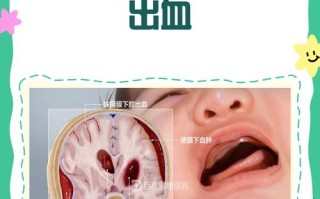 新生儿颅内出血的原因