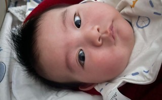 新生儿单眼皮会变双眼皮吗？遗传因素和发育阶段如何影响眼皮形态变化？