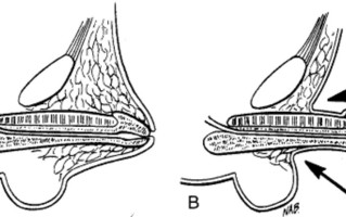 新生儿生殖器畸形究竟由哪些先天或后天因素共同导致？