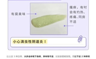 孕期分泌物颜色异常是疾病信号吗？不同颜色代表什么健康问题？