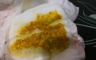 新生儿大便呈一粒粒状是正常还是异常？需要警惕哪些健康问题？