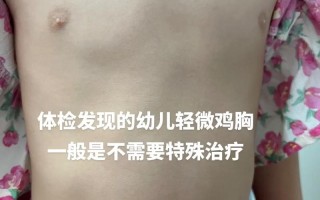 儿童气胸有哪些症状体征表现？