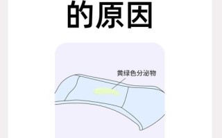 孕期白带呈现黄绿色真的是怀男孩的信号吗？这种说法有科学依据吗？