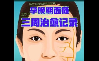 孕期面瘫究竟是谁在捣鬼？激素变化还是病毒感染作祟？