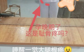 孕期大腿根部与胯连接处酸痛怎么办？