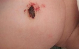 新生儿肚脐出血能洗澡吗？