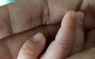 新生儿心脏病指甲发紫是心脏缺氧信号吗？需紧急就医排查哪些先天问题？