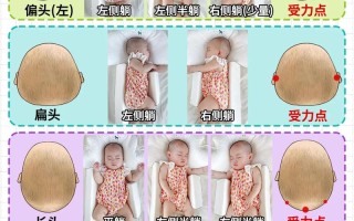 新生儿头顶尖一定要睡头型吗？科学调整姿势与时机指南