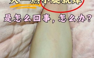 孕期小腿痒别大意！是皮肤干燥还是妊娠期肝内胆汁淤积症作祟？