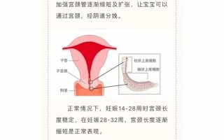 孕期宫颈短如何有效延长？科学方法与医学干预全解析