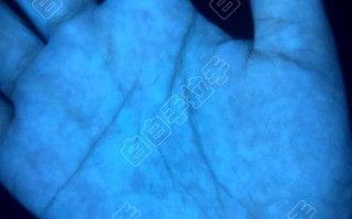 白白手拉手儿童治疗版