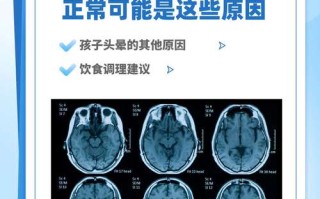 新生儿拍脑CT真的安全吗？辐射影响有多大？家长必须知道的真相！