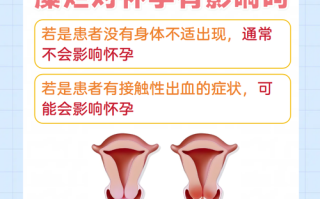 孕期宫颈糜烂需治疗吗？