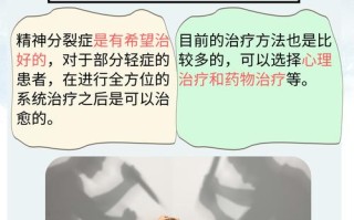 儿童精神分裂症好治吗