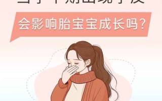 孕期大笑真的会伤到宝宝吗？医生揭秘大笑对胎儿发育的5大影响！