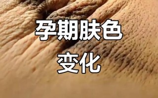 怀孕期间脸色发黄发黑是身体发出的什么健康信号？