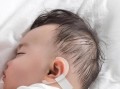 新生儿一只耳朵招风耳需要干预吗？会影响听力或后续发育吗？