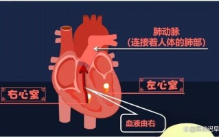 新生儿缺氧性肺动脉高压的发病机制与临床干预策略有哪些？