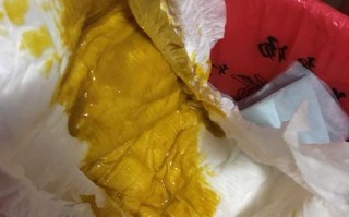 新生儿吃母乳就拉肚子，是母乳问题还是宝宝肠道不适应？