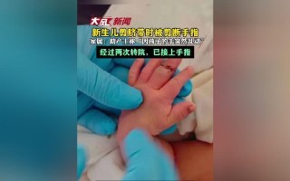 新生儿手爱在脸前乱动是正常发育信号还是需要干预的异常表现？