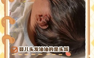 新生儿头发为何油油的？
