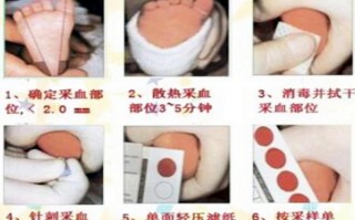新生儿足跟血采集位置选哪里才准确且安全？