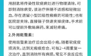 儿童软疣如何治疗才能彻底除根且避免复发？