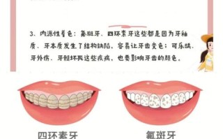儿童牙齿发黄怎么去除