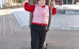 唐氏综合症新生儿有哪些典型表现？如何早期识别与干预？