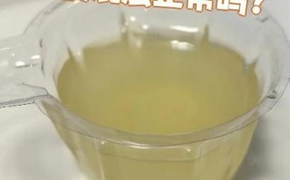 孕期小便混浊是女孩吗？这种说法有科学依据吗？