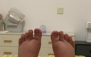 孕期五个月脚肿正常吗？需警惕哪些异常信号？