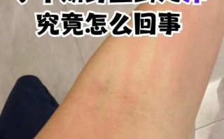 孕期身上痒是何原因？