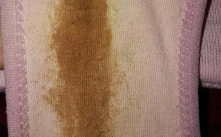 怀孕期间出现棕色分泌物，是正常现象还是身体异常信号？