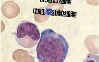 新生儿网织红细胞计数异常意味着什么？