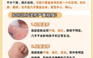 儿童湿疹反复发作，到底哪种方法才能真正有效根治且不复发？
