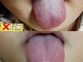 新生儿母乳喂养舌苔发白是何原因？
