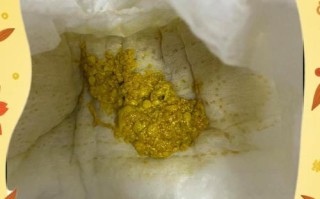 新生儿大便出现白色奶瓣是消化不良还是正常现象？