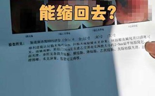 孕期遭遇痔疮困扰，顺产会加重症状吗？分娩方式该如何科学选择？