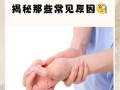 孕期手脚发麻是正常生理反应还是疾病信号？需警惕哪些潜在风险？