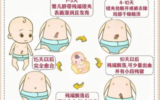 新生儿肚脐消毒该怎么做？不同消毒方法有何注意事项？