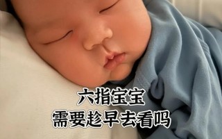 新生儿六指是遗传还是孕期异常？六指畸形会影响发育吗？