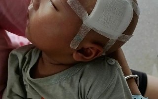 新生儿败血症 脑膜炎