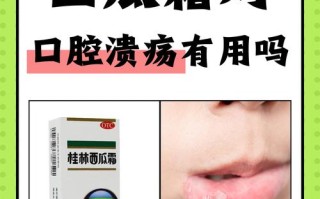 儿童口腔溃疡能用西瓜霜吗？