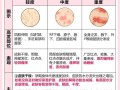 孕期皮肤瘙痒难忍？这5个安全缓解方法，孕妈妈能放心用吗？