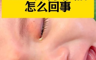 新生儿眼角总出黄眼屎、流泪，是上火还是眼部感染？